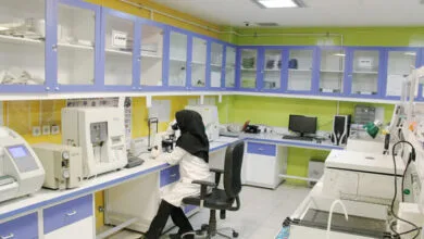 محققان کاشانی کیت تشخیص سریع کیست هیداتید ساختند